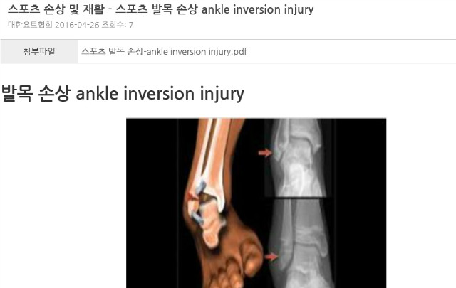 ankle_injury.jpg